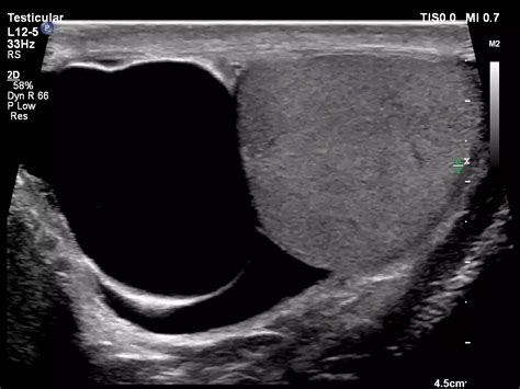 Philips Affiniti 30 Ultrasound System Philips