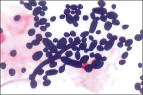 Кандида Микробиология – Telegraph