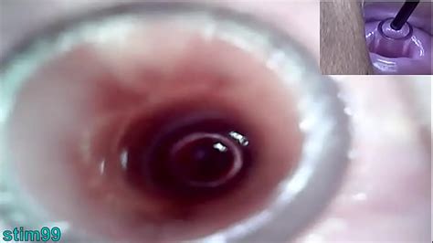 Lesbians Extreme Cervix Play And Peehole Fucking Penis Dildo Xxx Mobile Porno Videos Movies