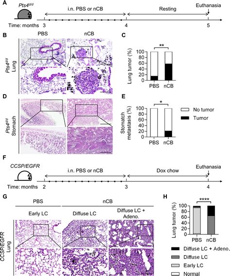 Ультрадисперсные частицы могут изменить защиту от рака легких - Наука и ...