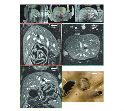 | Highlights of pig #1 experiment. (A-C) In-situ targeting based on ...