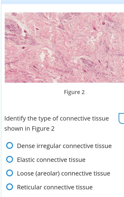 Solved Figure 1 Identify The Type Of Connective Tissue Shown Chegg