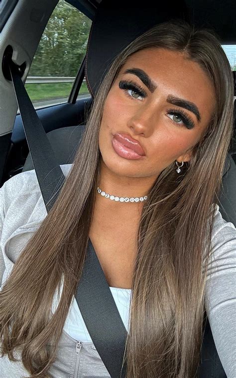 Essex Chav Amber With Her Lip Filler R Hot Chavs