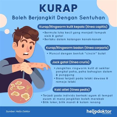 nak hilangkan kurap  celah peha alainaabbsheppard