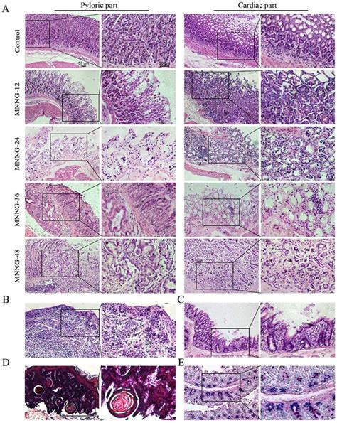 Histology Of The Control And Mnng Induced Rat Gastric Tissues A