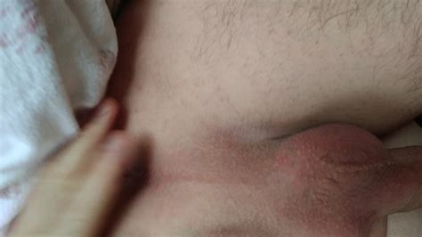 Doigtage Anal Xhamster