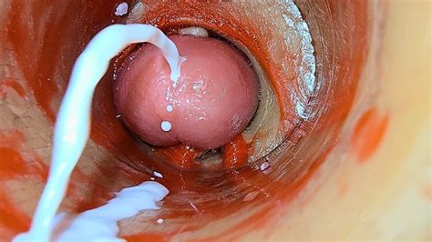 Camera Inside Deep Pussy Captures Overdose Ejaculation Of Sperm Asmr
