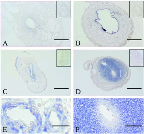 Cross Sections Of Pregnant Uteri In Situ Hybridization Using Antisense