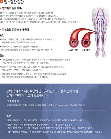 동맥경화증 치료 동맥경화증 예방식 동맥경화도 검사 자식을막아