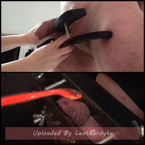 Forumophilia PORN FORUM Extreme Anal Dilation And Anal Pussy