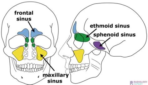 CT PARANASAL SINUS PNS WITH CONTRAST FOR IGS AskRadiographerDotCom