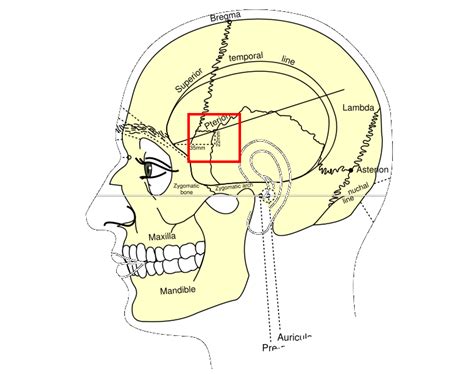 pterion wikidoc