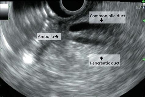 Bile Duct Radiology Key