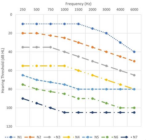 Flat And Moderately Sloping Standard Audiograms Download Scientific Diagram