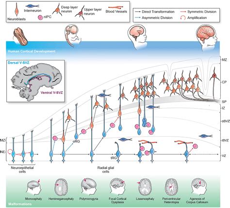 Frontiers | Cortical Malformations: Lessons in Human Brain Development
