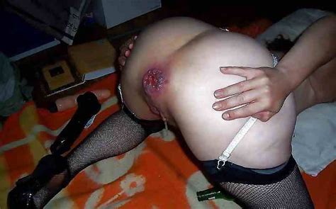 Dirty Ass Gape Porn Pictures Xxx Photos Sex Images Pictoa