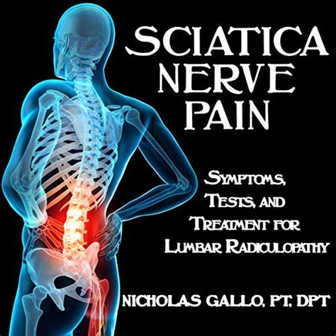 Sciatica Nerve Pain Symptoms Tests And Treatments For Lumbar