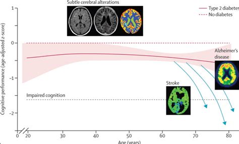 Heartburn drugs, dementia, Alzheimer's risk for all? T2D, is it the ...