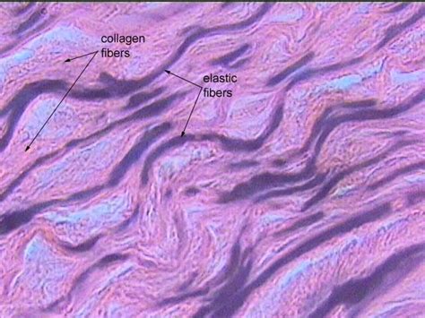 Elastic Tissue Labeled