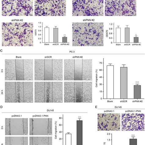 PNN Accelerates Prostate Cancer Cell Invasion And Migration In Vitro