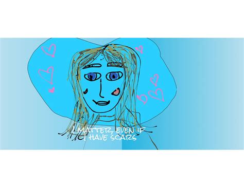 Skin Picking Dermatillomania Art By Suffers And Supporters Of The