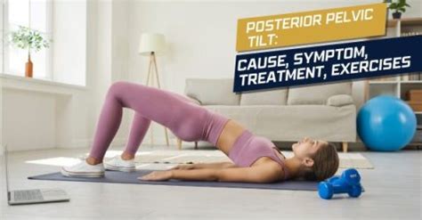 Posterior Pelvic Tilt Cause Symptom Treatment Exercises Fitwithiit