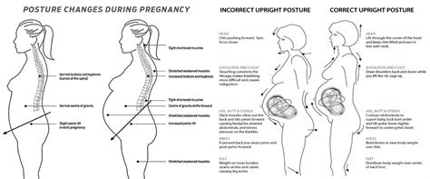 妊娠中の姿勢の健康 エルパソ バック クリニック