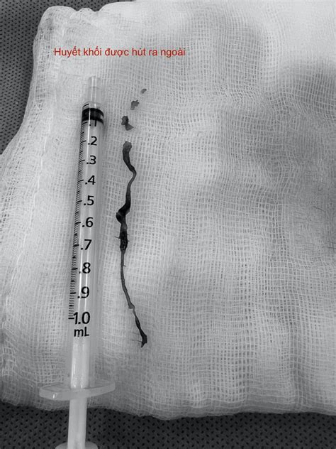 Tin Nhắc nhở tiệm rửa xe để cô gái mặc bikini chụp hình gây phản cảm không khí lạnh đang