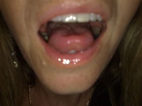 Amateur Photos 913 Nude Photos6569 25220 Porn Pic