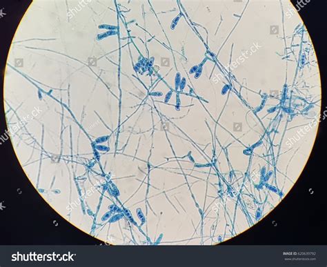 Macroconidia Epidermophyton Light Microscope Stock Photo 620639792 ...