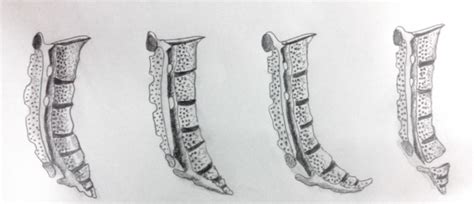 Боль в копчике