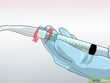 Ways To Remove A Urinary Catheter Wikihow