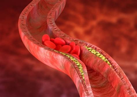 Cholesterol LDL HDL i trójglicerydy jakie są normy