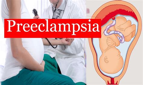 Pre Eclampsia Diagnosis And Treatment Pretoria Evergreen Gynaecology