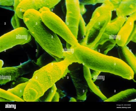 False Colour Scanning Electron Micrograph Sem Of Culture Of The