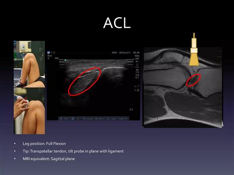 Ultrasound - Knee | PDF