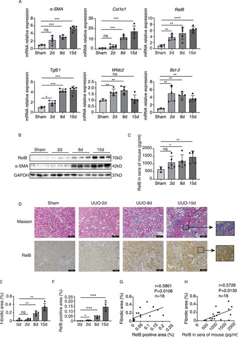 Relb Is Induced After Uuo And Correlated With Kidney Fibrosis In Mice