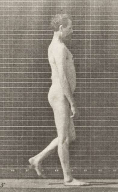 Nude Man With Locomotor Ataxia Walking With Both Arms Up And Down Rbm Qp M A