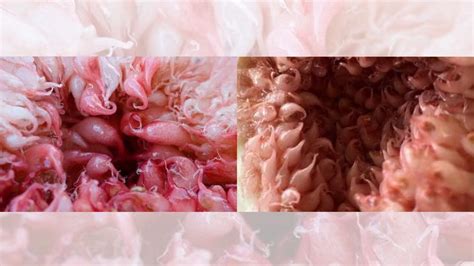 Pics Show A Vagina Under A Microscope Snopes