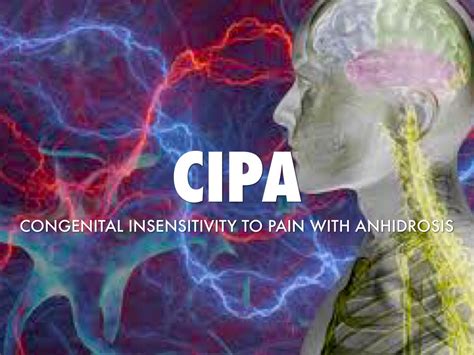 CIPA by Delana Muns