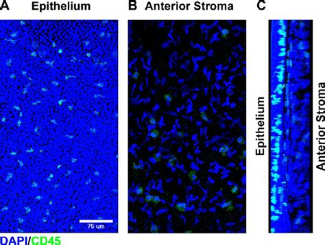 Bone Marrow Derived Cells Within The Normal Human Cornea Fresh Donor