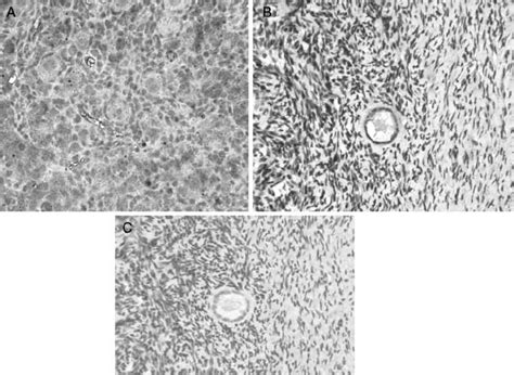 Immunocytochemical Photographs Of Ngf Staining A Section Of A