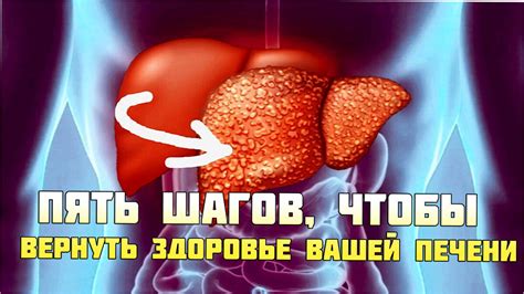 Забудьте о Жировом гепатозе: Пять шагов, чтобы вернуть здоровье вашей ...