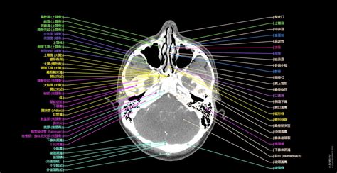 頭頚部 Ct 正常解剖学 E Anatomy