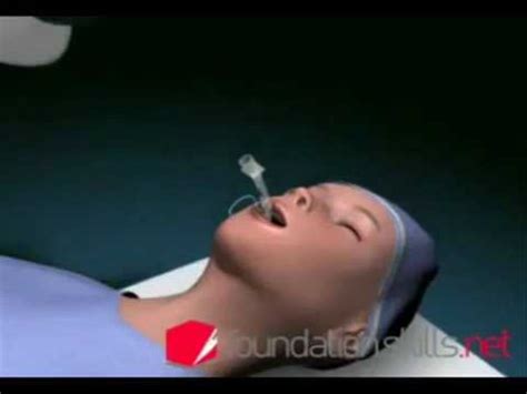 Интубация - YouTube