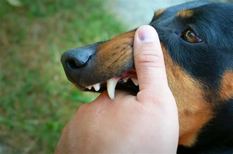 Cid Mordedura De Cachorro 9