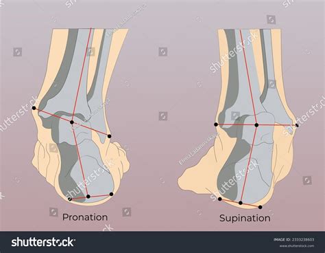 pronated ankle images stock  vectors shutterstock