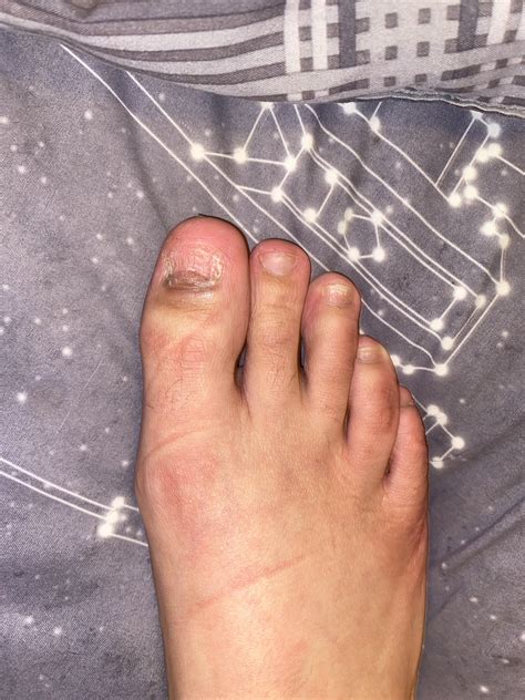 Another nail question🤦🏻‍♀️🤦🏻‍♀️🤦🏻‍♀️ sorry but I noticed this the last