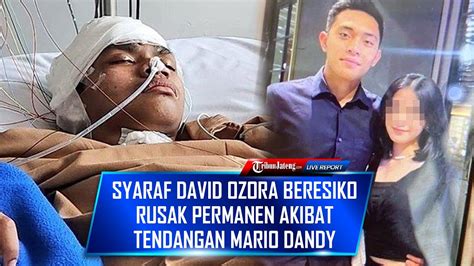 Update Kondisi David Ozora Syaraf Beresiko Rusak Permanen Akibat