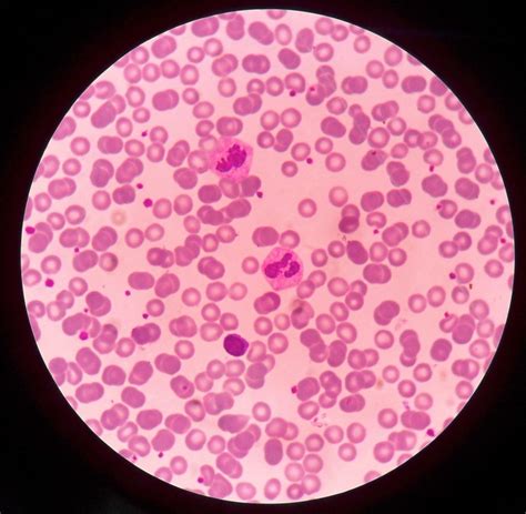 Tecnología Médica • Frotis Sanguineo